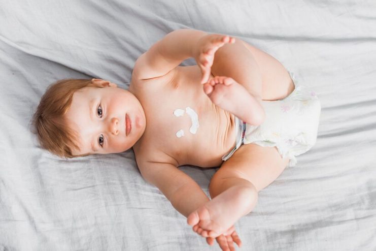 How to Treat Diaper Rash in Newborns