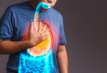 How to Treat Heartburn How to Treat Heartburn
