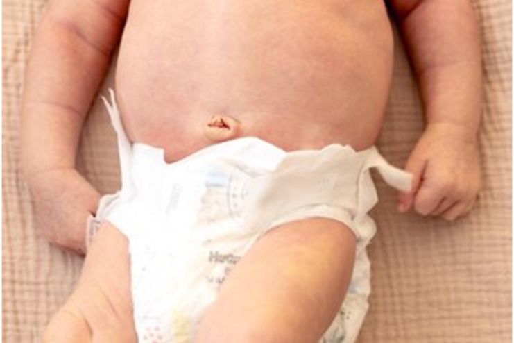 What is Diaper Rash