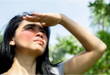 How to Get Rid of Sunspots How to Get Rid of Sunspots