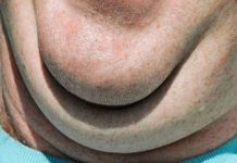 How to Get Rid of Double Chin how to get rid of double chin
