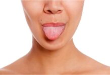 How to Get Rid of Wavy Tongue How to Get Rid of Wavy Tongue