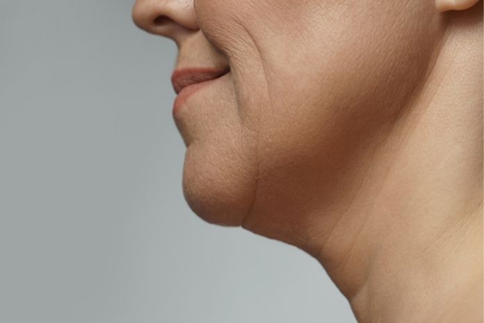 How to Get Rid of a Double Chin How to Get Rid of a Double Chin