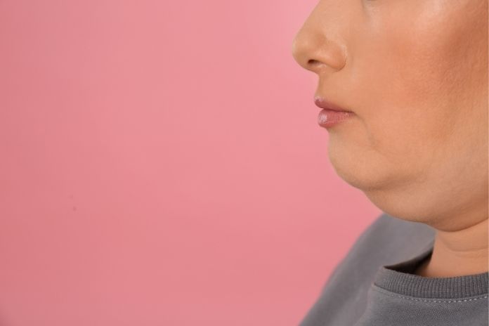 What Actually Causes a Double Chin
