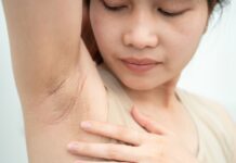 Armpit Lumps: Causes, Diagnosis & Treatment Armpit Lumps Causes Diagnosis Treatment