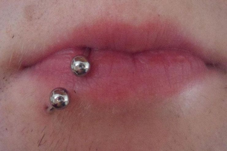 All You Need to Know About Lip Piercing