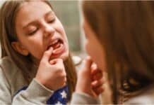 Home Remedies to Strengthen Shaking Teeth Home Remedies to Strengthen Shaking Teeth