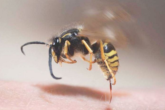 wasp sting