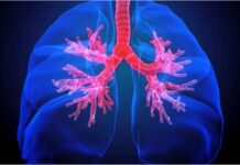 How to Remove Fluids From Lungs 4 Natural Remedies to Remove Armpit Rashes