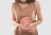 Ulcerative Colitis: Causes, Symptoms, and Treatment Ulcerative Colitis