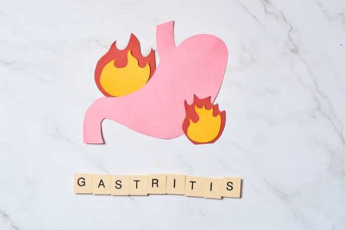 Causes And Home Remedies For Gastritis Causes And Home Remedies For Gastritis
