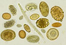 Parasite Cleanse Diet: Foods To Eat And Avoid Parasite Cleanse Diet