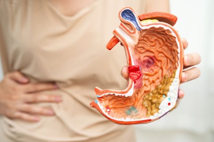 What Is Gastritis And Why Does The Cause Matter More Than The Symptoms