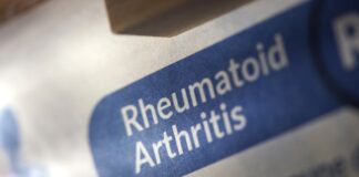 Effective Home Remedies for Rheumatoid Arthritis (RA) Effective Home Remedies for Rheumatoid Arthritis