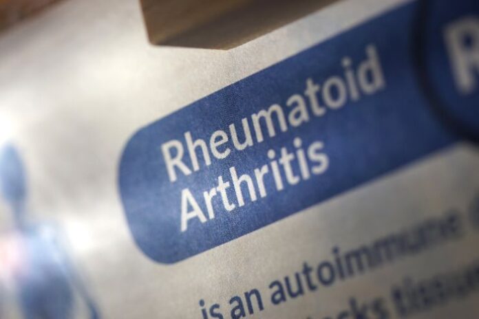 Effective Home Remedies for Rheumatoid Arthritis