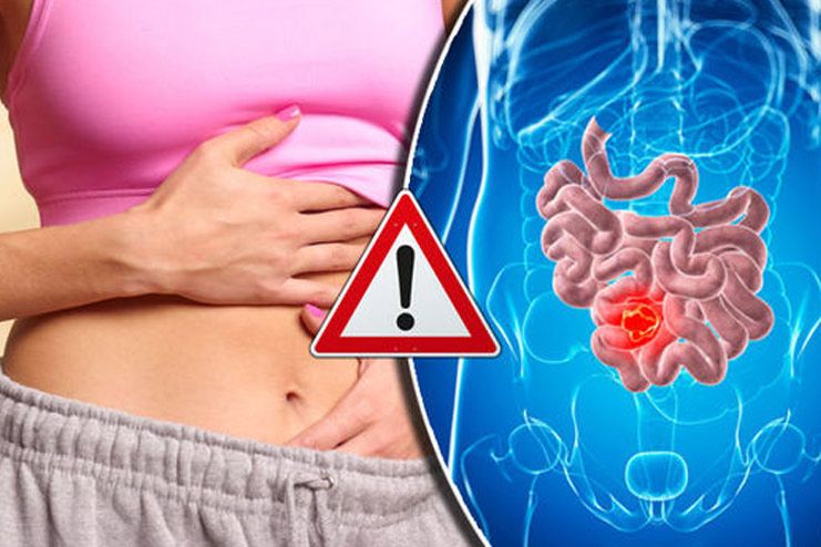 21 Simple And Proven Constipation Home Remedies (That Actually Work!)
