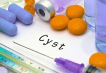 Heal Sebaceous Cysts Naturally: 18 Effective Home Remedies Heal-Sebaceous-Cysts-Naturally