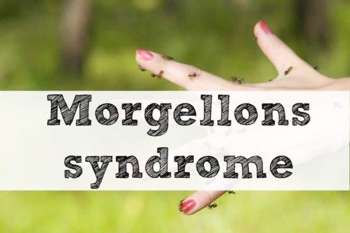 Morgellons