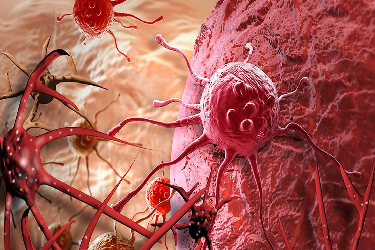 New Study Shows a New Approach to Cancer Treatment