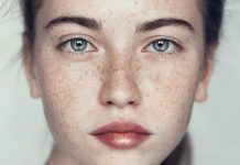 9 Easy and Effective Home Remedies for Freckles Removal At Home freckles treatment