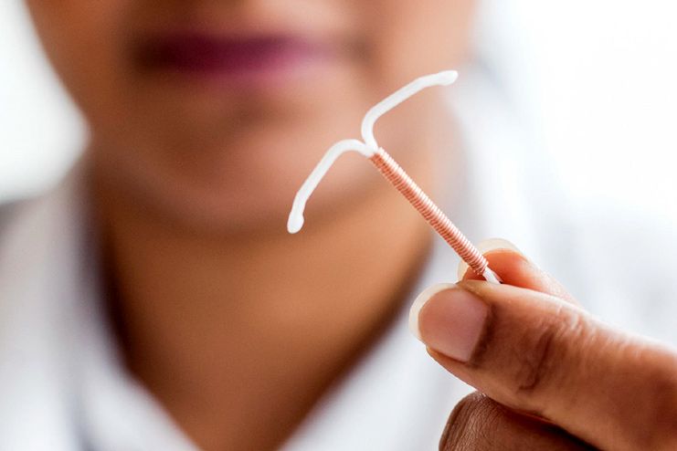 New Study finds IUD As A Potent Protector Against Cervical Cancer
