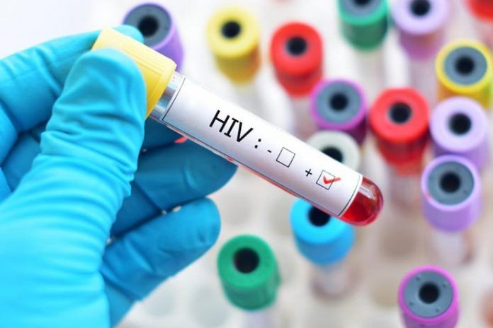 HIV-Vaccine-Strategy