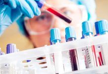 ‘Liquid Biopsy’ for Early Detection of Cancer, New Study Suggests Liquid-Biopsy