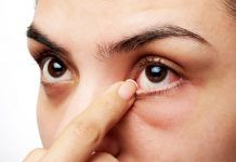 16 Effective Cures For Dry Eyes That Work Like Magic cure for dry eyes