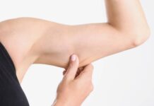 How To Get Rid Of Loose Skin? 11 Fool Proof Methods How to Get Rid Of Loose Skin