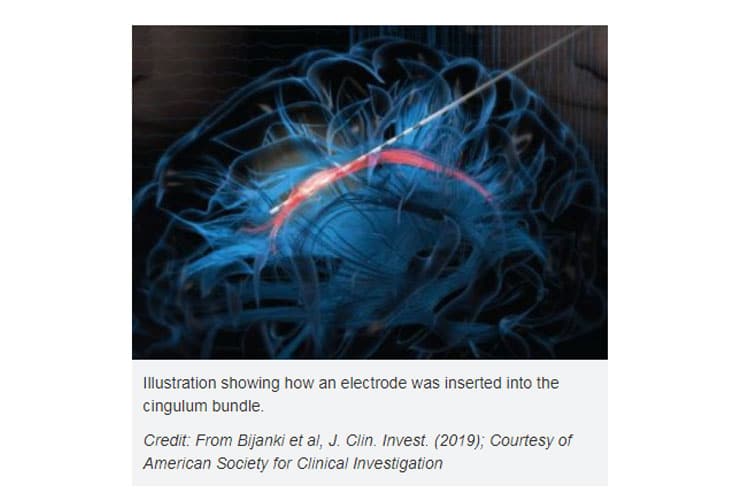 Brain-surgery