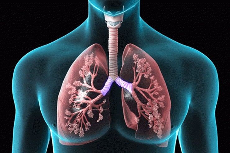 Chronic Obstructive Pulmonary Disease