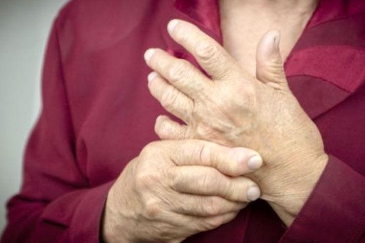 8 Best Hand Exercises for Arthritis