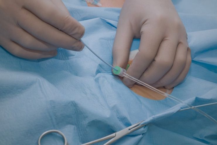 Cardiac catheterization