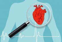 Congenital Heart Disease – Causes, Symptoms, Diagnosis And Treatment Congenital heart disease