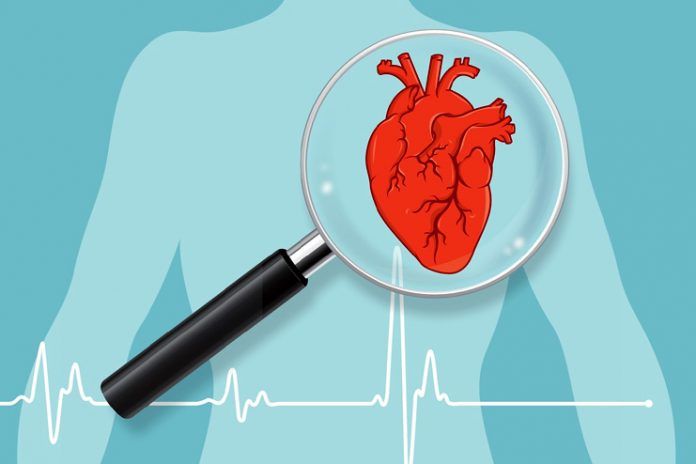 Congenital heart disease