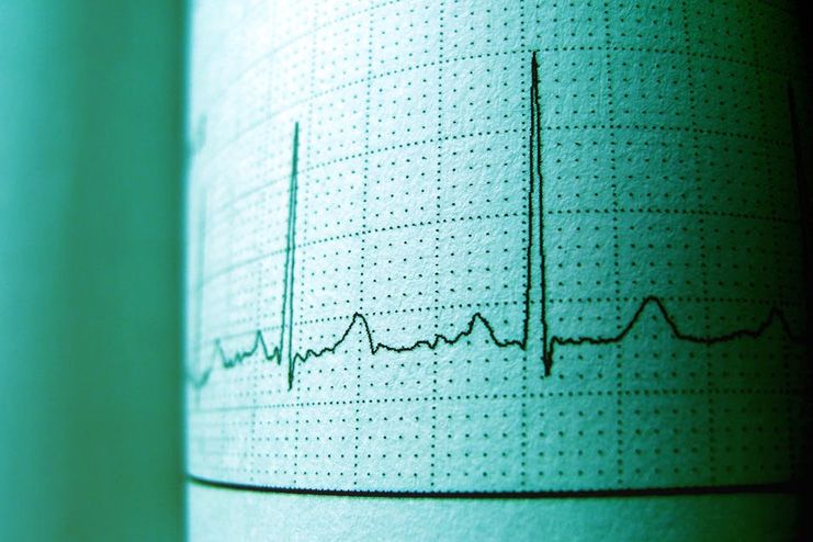 Electrocardiogram