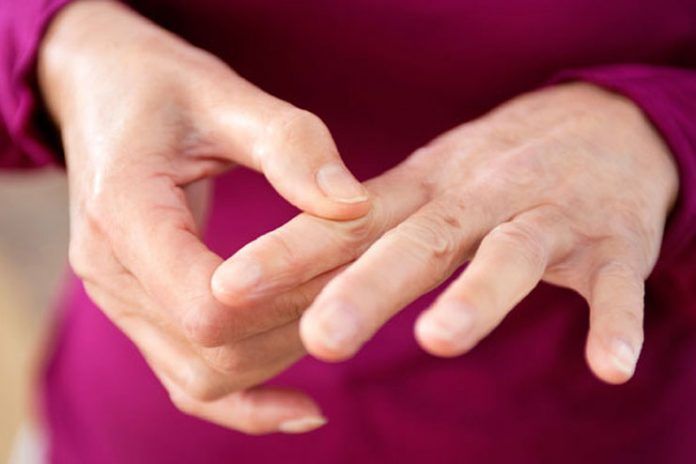 Hand exercises for arthritis