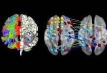 Neuroimaging Finds That Brain Uses More Power To Remember Than Forget A Memory Neuroimaging