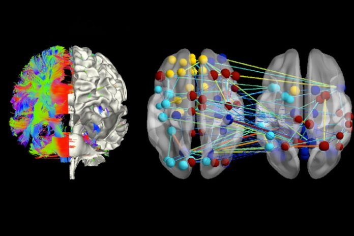 Neuroimaging