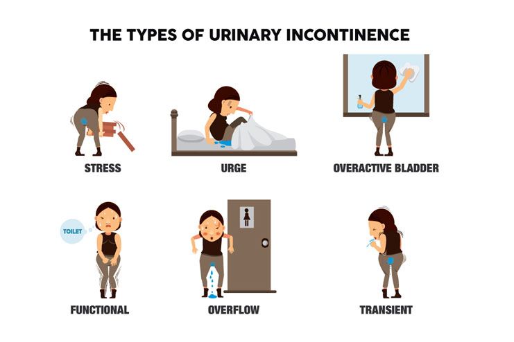 Types Of Urinary Incontinence