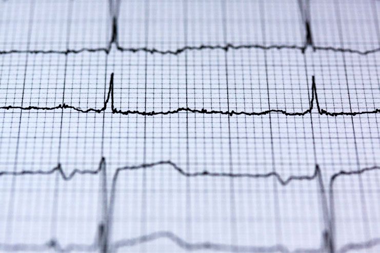 Types of Heart Test