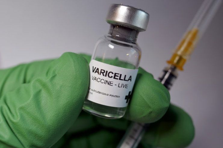 Varicella Chicken pox