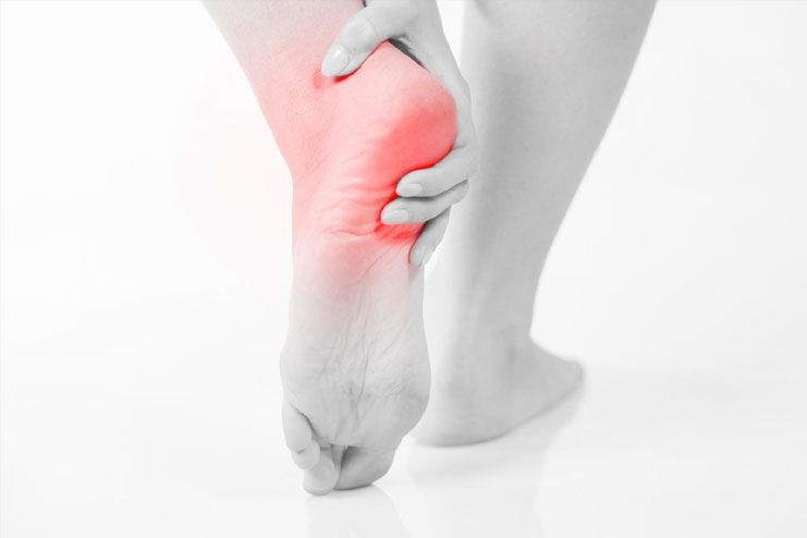 What are the symptoms of Heel Spur