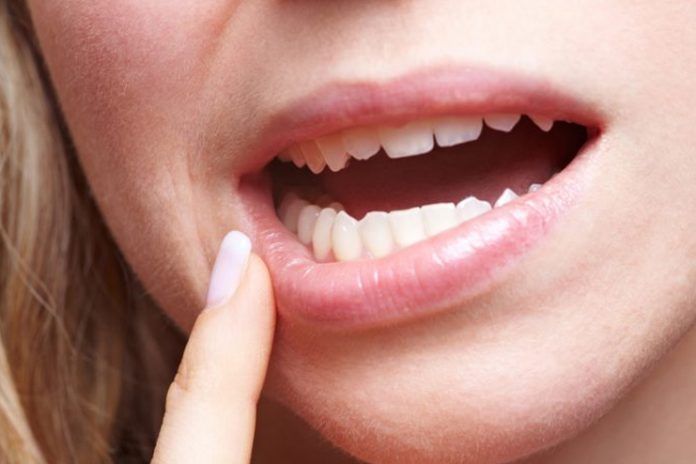 natural remedies for receding gums