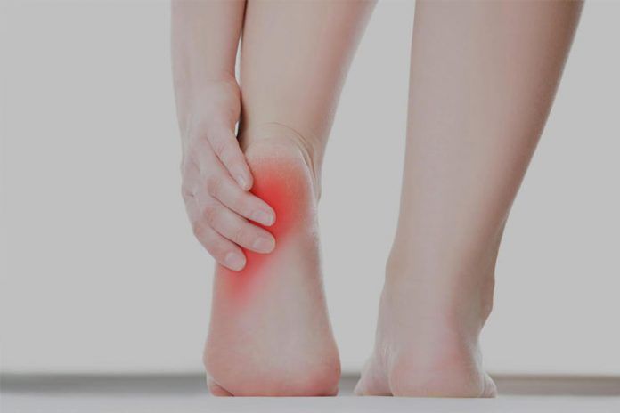 remedies for heel spur