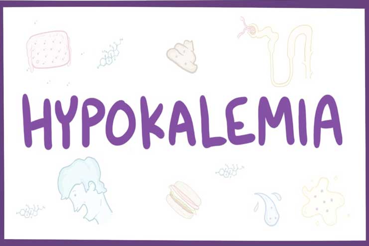 Hypokalemia