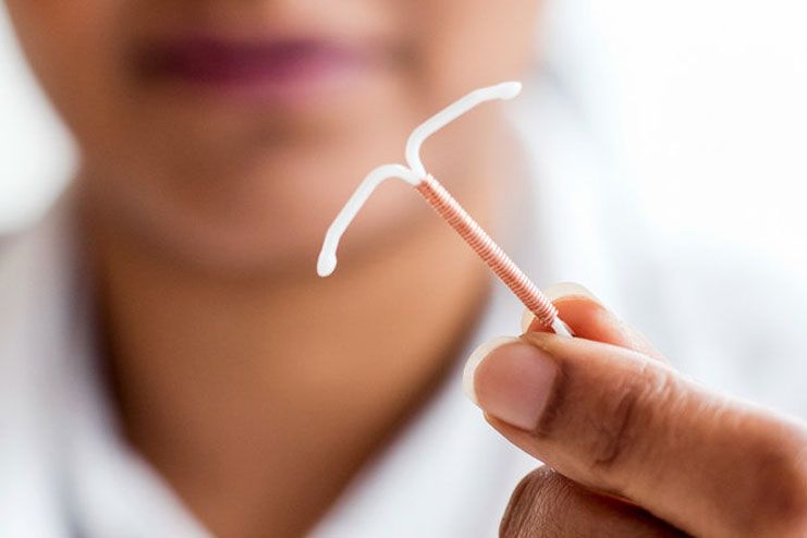 IUDs can rip the head of the sperm