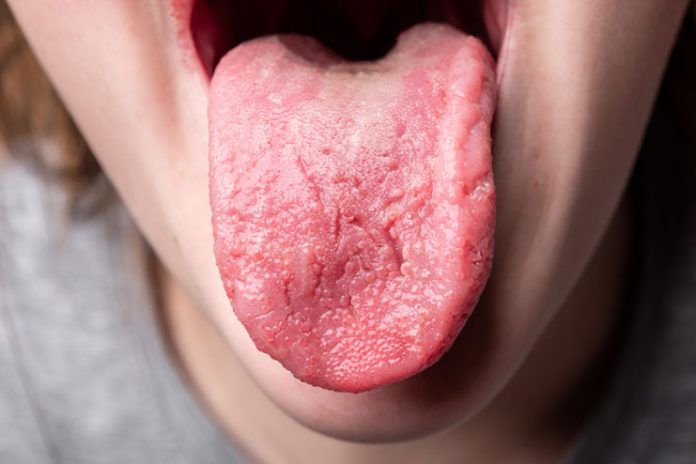 foods that help get your taste buds back after radiation pill foods that help get your taste buds back after radiation pill