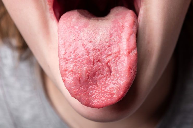 how do you get your taste buds to come back how do you get your taste buds to come back