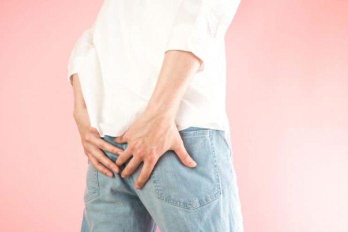 remedies for pilonidal cyst
